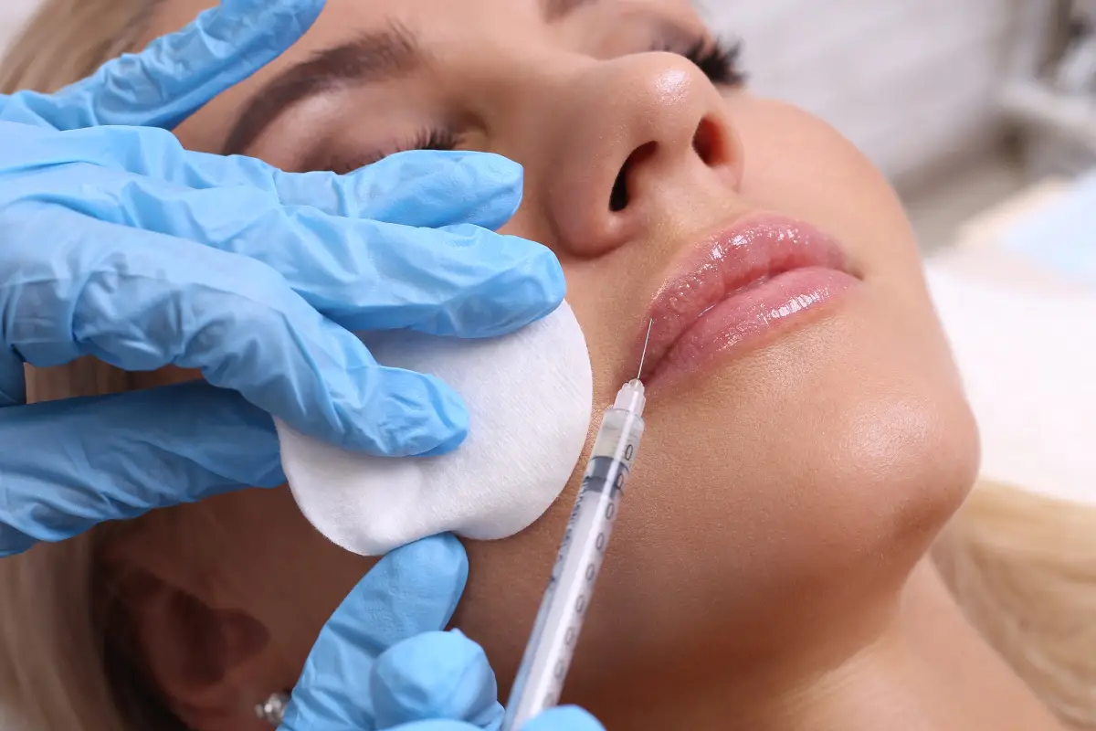 Lip Fillers and Lip Injections in Draper, Utah at Femme Moderne Center for Aesthetics