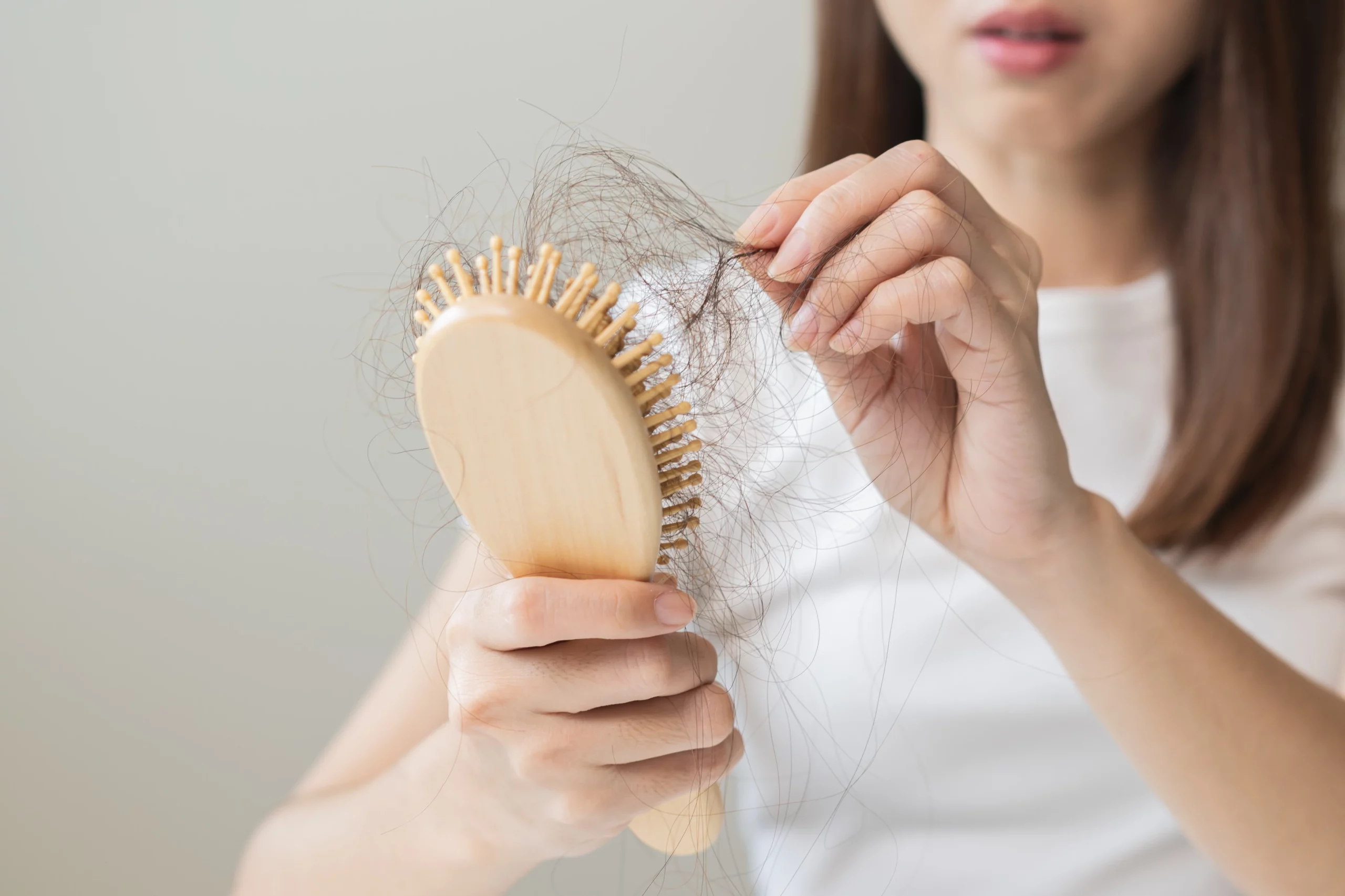 Hair Loss Treatment in Draper, UT
