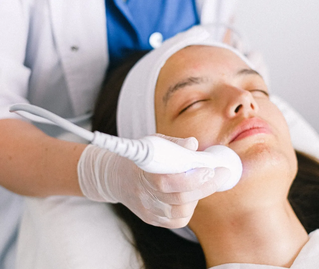 Microneedling