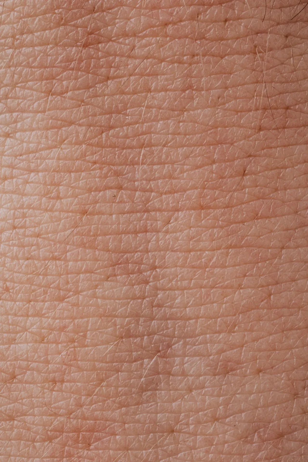 Fine Lines | Femme Moderne Center for Aesthetics in Draper, Utah