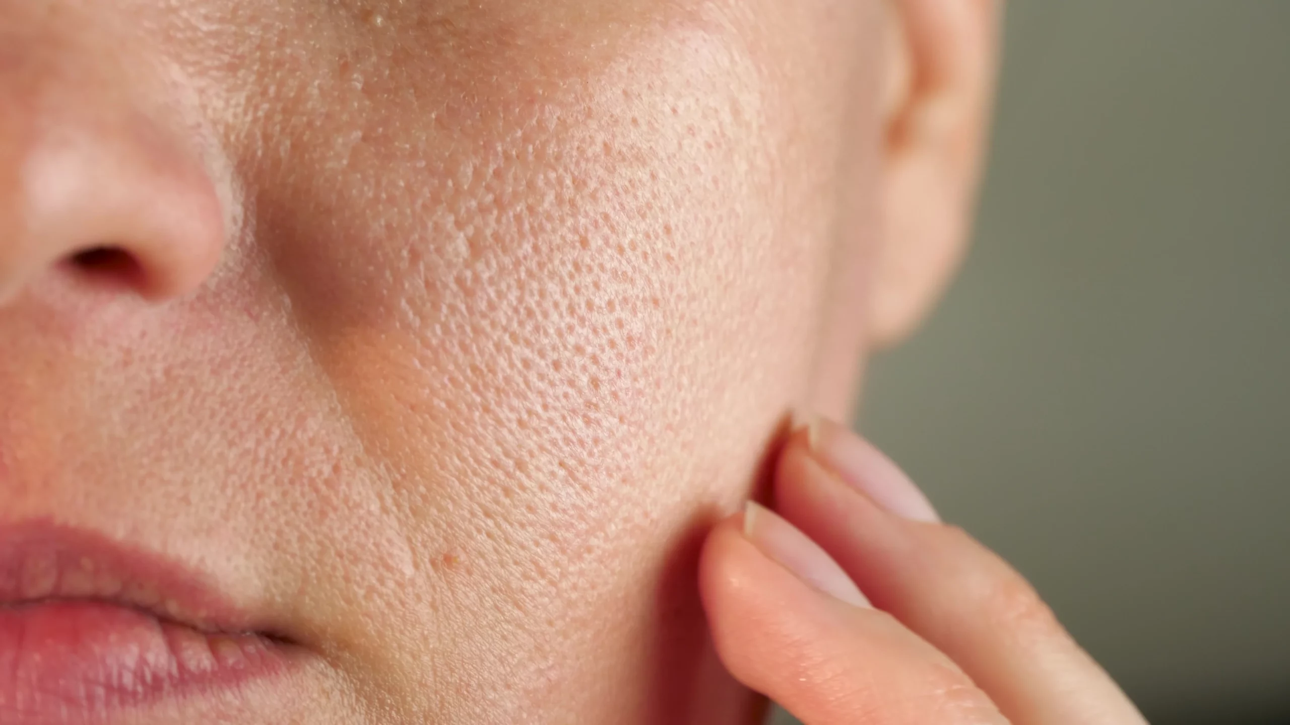 A woman Large Pores Treatment in Draper, UT